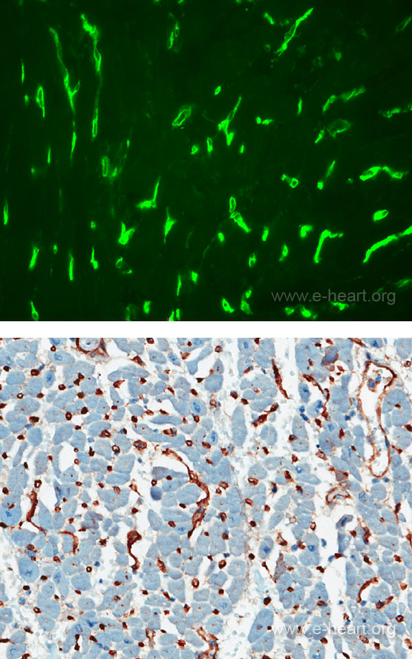 C3d IF and IHC